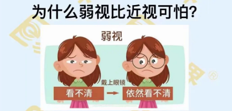 為什么弱視比近視可怕？
